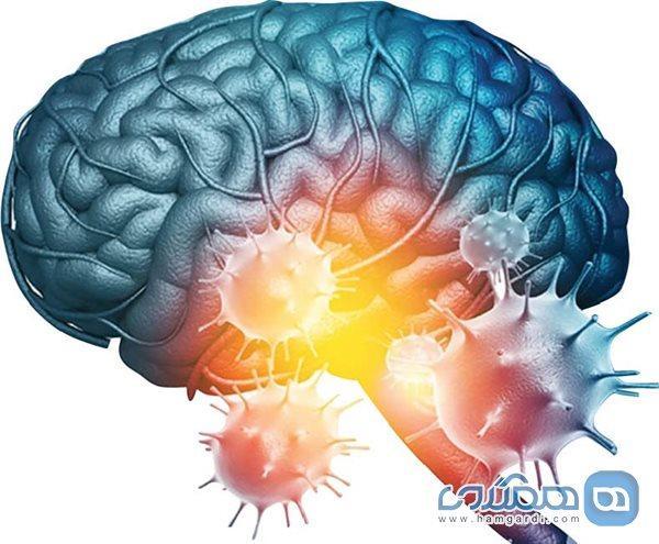 آیا کووید 19 خطر سکته مغزی را افزایش می دهد؟
